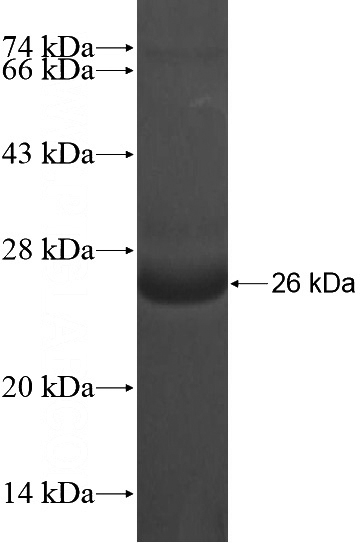 Recombinant Human NKIRAS2 SDS-PAGE
