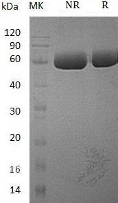 Human SMPDL3A/ASML3A (His tag) recombinant protein