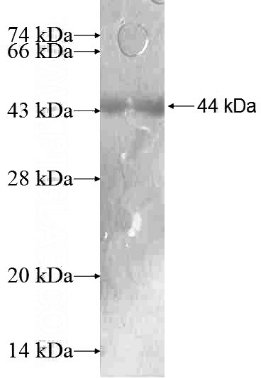 Recombinant Human CPT1A SDS-PAGE