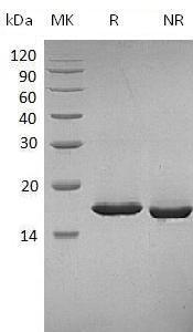 Carassius auratus Leptin (His tag) recombinant protein