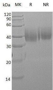 Human FCAR/CD89 (His tag) recombinant protein