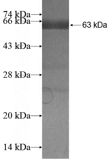 Recombinant Human USP2 SDS-PAGE