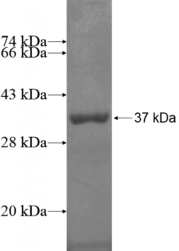 Recombinant Human ZNF324 SDS-PAGE