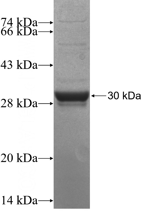 Recombinant Human CXCL16 SDS-PAGE