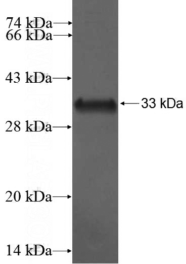 Recombinant Human S100Z SDS-PAGE