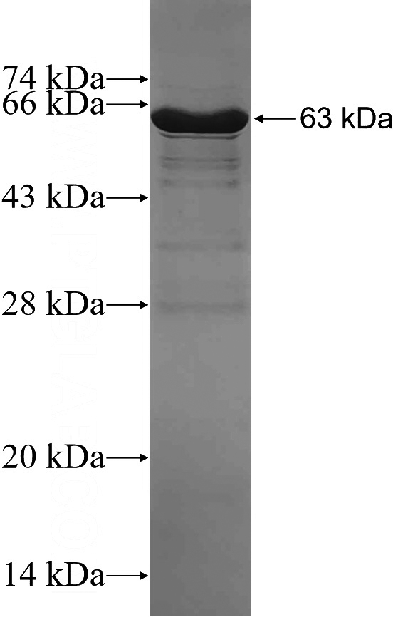 Recombinant Human MAD2L1BP SDS-PAGE