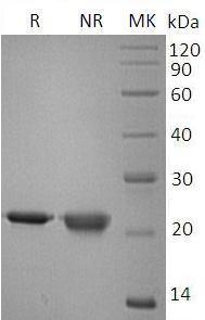 Human IL18/IGIF/IL1F4 (His tag) recombinant protein