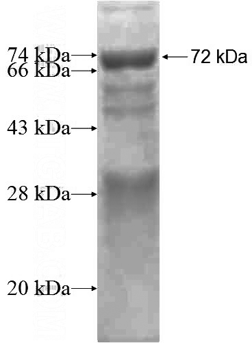 Recombinant Human NARF SDS-PAGE