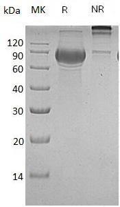 Human CD19 (Fc tag) recombinant protein