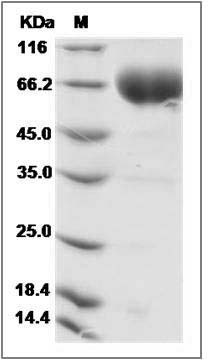 Human SLAMF6 / Ly108 Protein (Fc Tag) SDS-PAGE