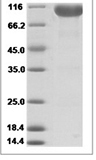 Human LILRB1 / CD85j / ILT2 Protein (Fc Tag)