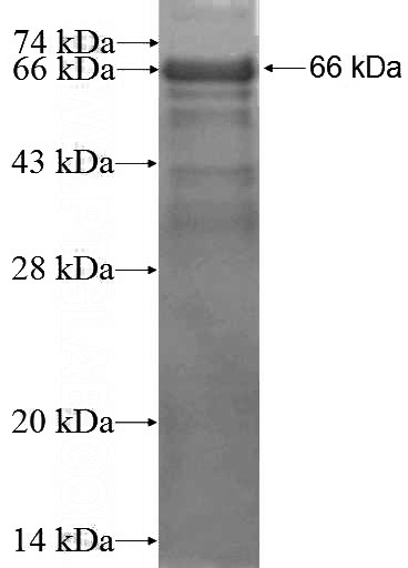 Recombinant Human SETDB1 SDS-PAGE