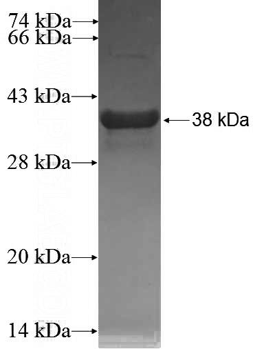 Recombinant Human RABL5 SDS-PAGE