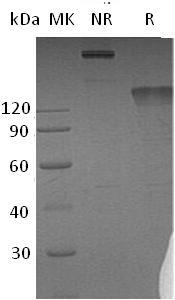 Human SEMA4D/C9orf164/CD100/SEMAJ (Fc tag) recombinant protein