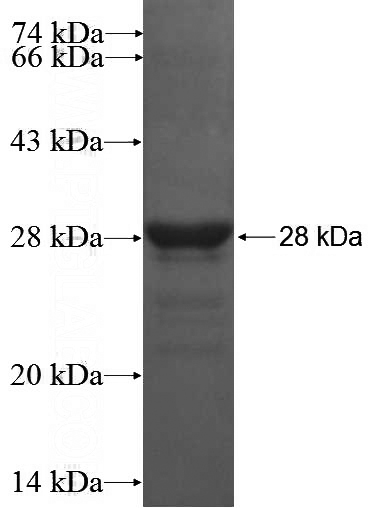 Recombinant Human C1orf110 SDS-PAGE