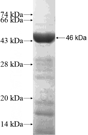 Recombinant Human ABTB2 SDS-PAGE