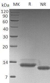 Human B2M/CDABP0092/HDCMA22P (His tag) recombinant protein