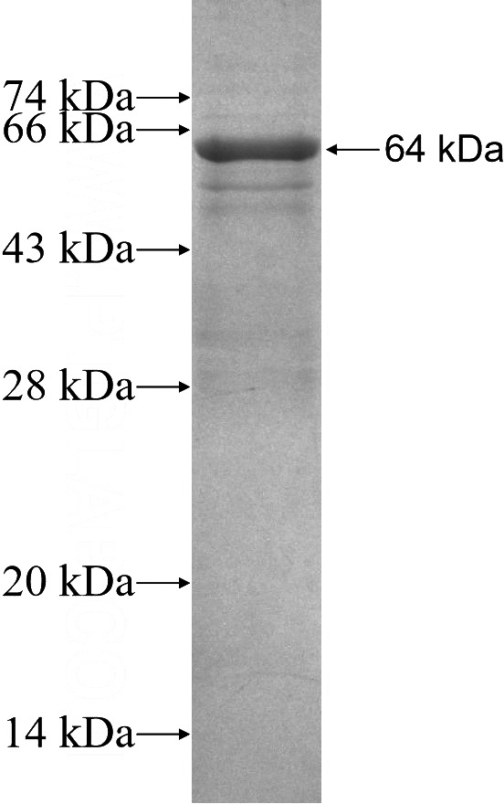 Recombinant Human PGS1 SDS-PAGE