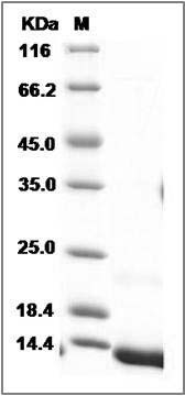 Human NAP-2 / PPBP / CXCL7 Protein (His Tag) SDS-PAGE