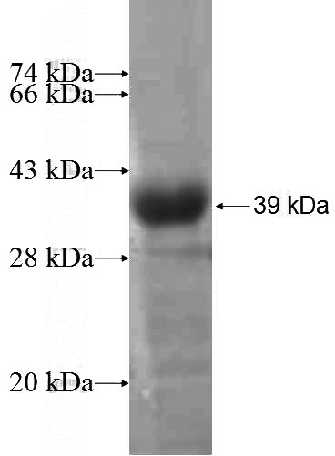Recombinant Human SPAG8 SDS-PAGE