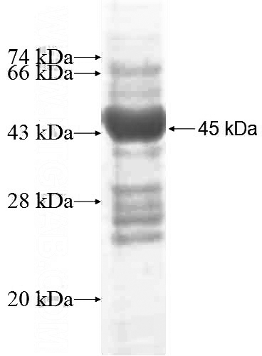 Recombinant Human AP1S2 SDS-PAGE