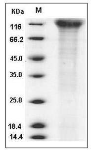 Human CD96 Protein (His Tag) SDS-PAGE
