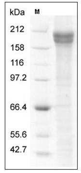 Human JAG1 / Jagged 1 / CD339 Protein (Fc Tag) SDS-PAGE