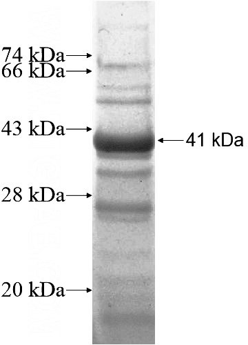 Recombinant Human SH3BP4 SDS-PAGE