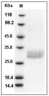 Human C1QB / C1qB Protein (His Tag) SDS-PAGE