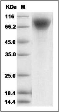 Cynomolgus IFNAR1 / IFNAR Protein (His Tag) SDS-PAGE