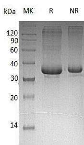 Human ACRV1 (His tag) recombinant protein