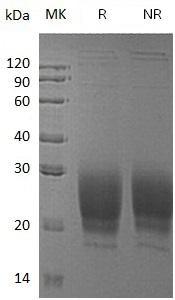 Human PRND/DPL/UNQ1830/PRO3443 (His tag) recombinant protein