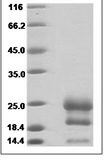 Human Interferon Gamma/IFN gamma/IFNG Protein 14823
