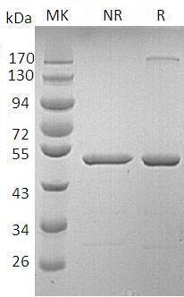 Human GCA/GCL (GST tag) recombinant protein