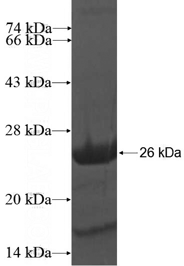 Recombinant Human RAB6B SDS-PAGE