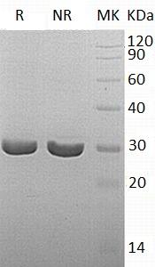 Human QDPR/DHPR/SDR33C1 (His tag) recombinant protein