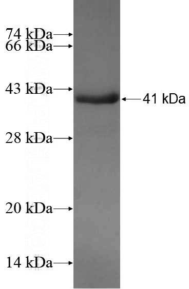 Recombinant Human ARMC8 SDS-PAGE