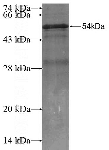 Recombinant Human SNAP29 SDS-PAGE