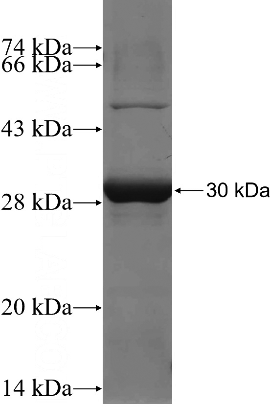 Recombinant Human EGLN3 SDS-PAGE