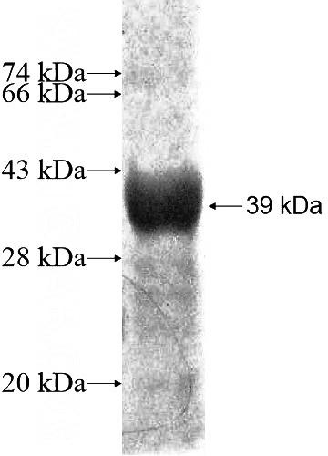 Recombinant Human AUH SDS-PAGE