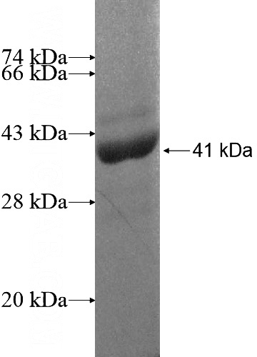 Recombinant Human LZTFL1 SDS-PAGE