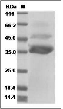 Canine ANGPTL7 / Angiopoietin-like 7 Protein (His Tag) SDS-PAGE