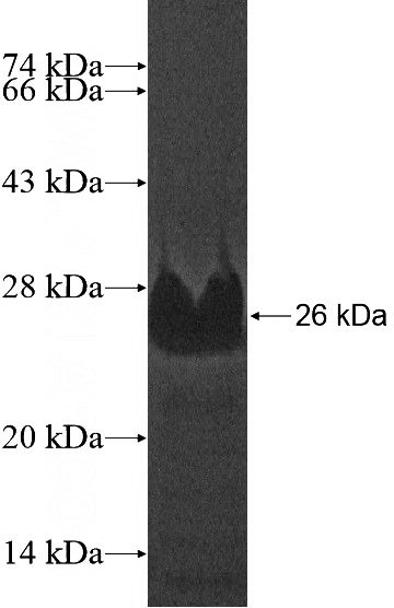 Recombinant Human RNF139 SDS-PAGE