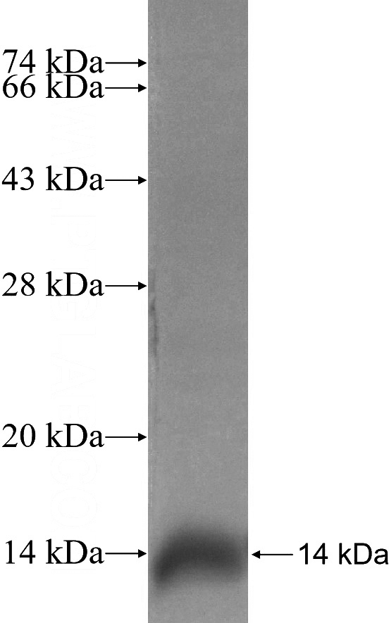 Recombinant Human RAB10 SDS-PAGE