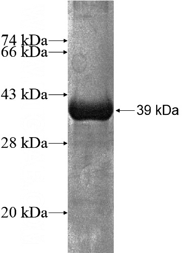Recombinant Human ZNF57 SDS-PAGE