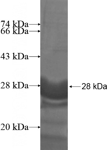 Recombinant Human LYSMD2 SDS-PAGE