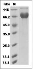 Mouse JAML / AMICA1 Protein (Fc Tag) SDS-PAGE