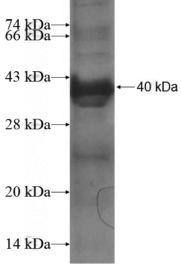 Recombinant Human POLH SDS-PAGE