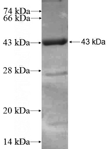 Recombinant Human COG7 SDS-PAGE