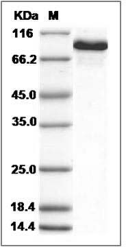 Rat Transferrin / TF Protein (His Tag) SDS-PAGE